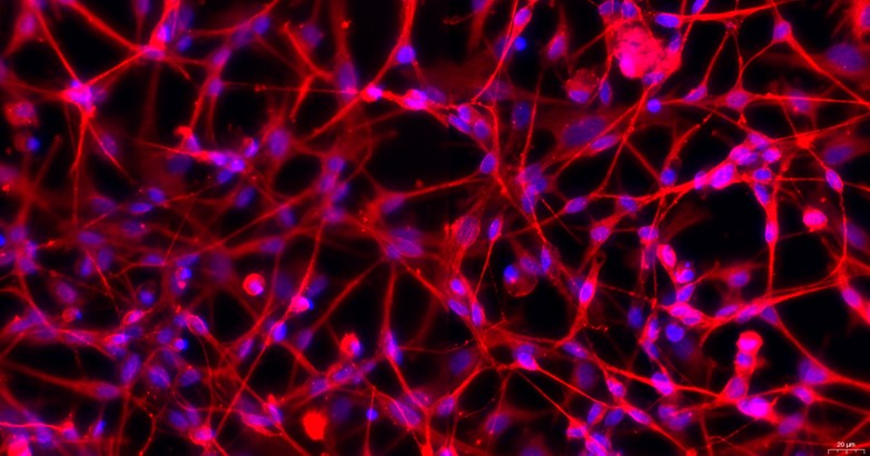 Primary Canine Dorsal Root Ganglion Neuron Cells (DRGN)