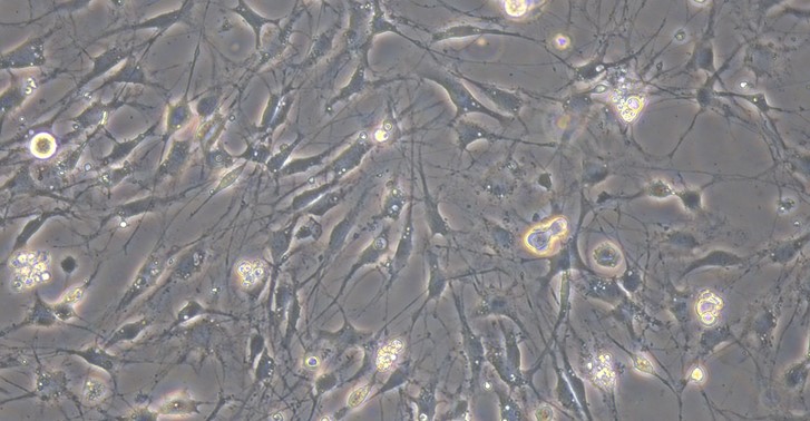 Primary Mouse Dorsal Root Ganglion Neuron Cells (DRGN)