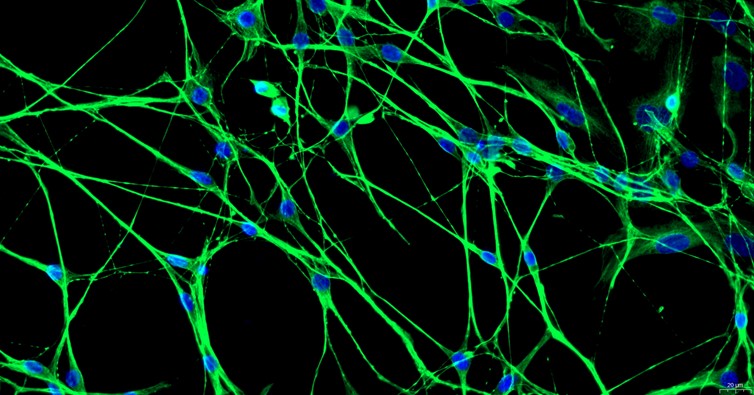 Primary Mouse Dorsal Root Ganglion Neuron Cells (DRGN)