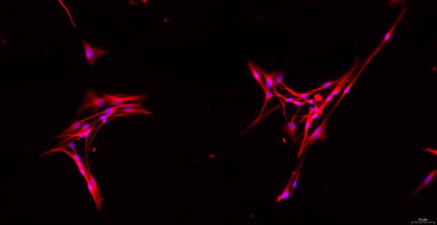 Primary Rat Dorsal Root Ganglion Neuron Cells (DRGN)