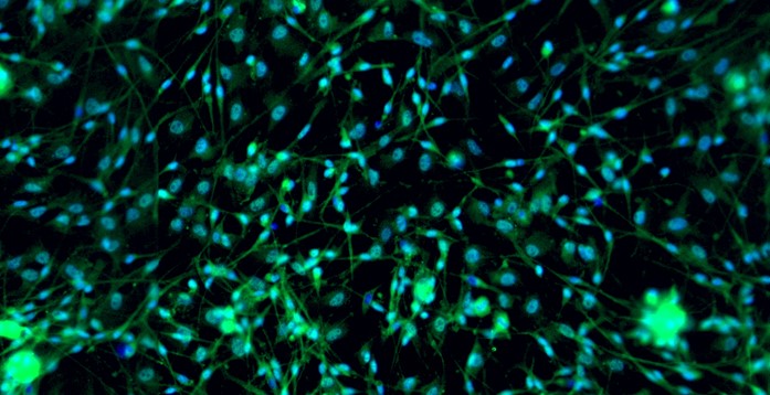 Primary Rat Dorsal Root Ganglion Neuron Cells (DRGN)