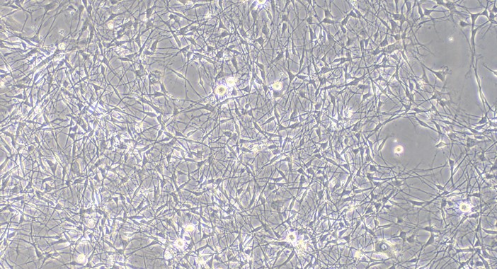 Primary Rat Dorsal Root Ganglion Neuron Cells (DRGN)