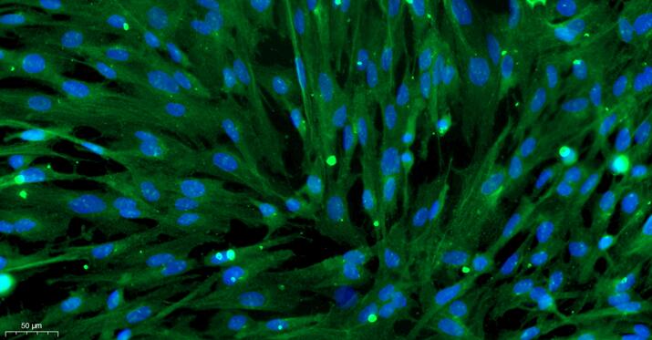 Primary Mouse Aorta Adventitial Fibroblasts (AAF)