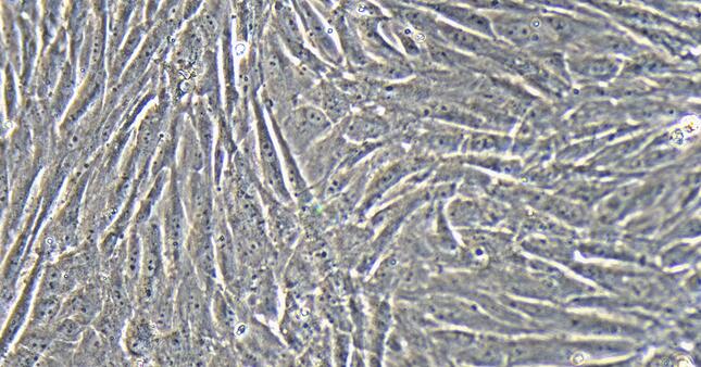 Primary Rat Retinal Muller Cells (RMCs)