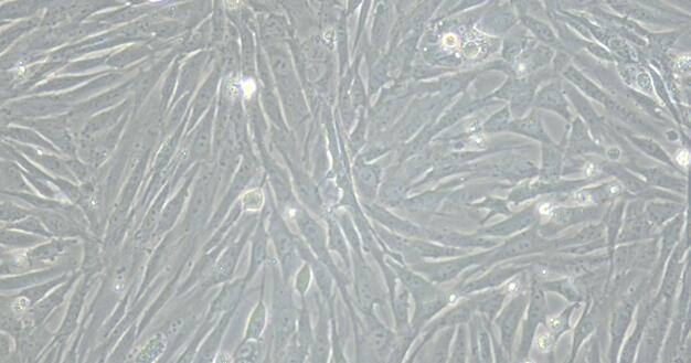 Primary Rabbit Epididymal Smooth Muscle Cells (EpSMC)