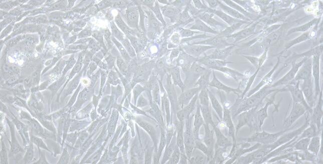 Primary Rabbit Seminal Vesicle Smooth Muscle Cells (SVSMC)