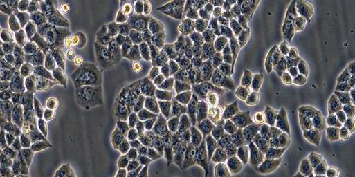 Human HaCat Epidermal Cells (HaCat)