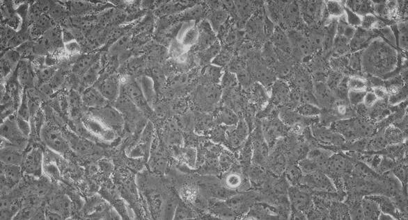 Human 143B Osteosarcoma Cells (143B)