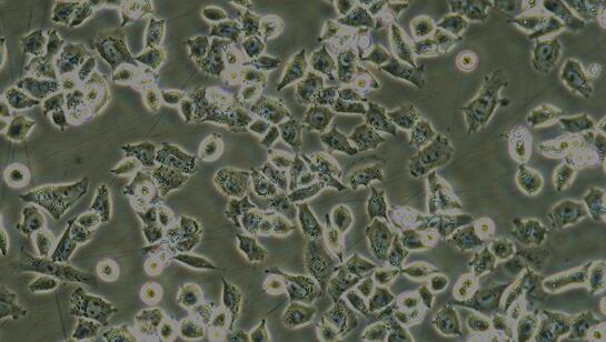 Human A2780 Ovarian Carcinoma Cells (A2780)