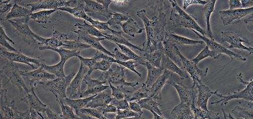 Human SW579 Thyroid Carcinoma Cells (SW579)