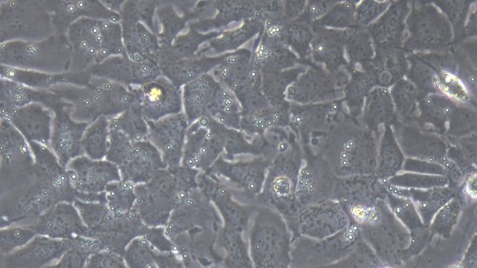 Human Hep3B Hepatocellular Carcinoma Cells (Hep3B)