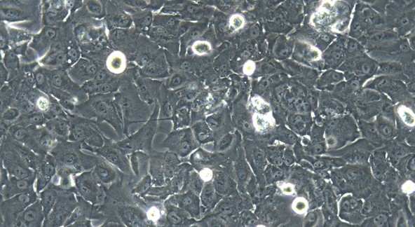 Human OS-RC-2 Renal Cancer Cells (OS-RC-2)