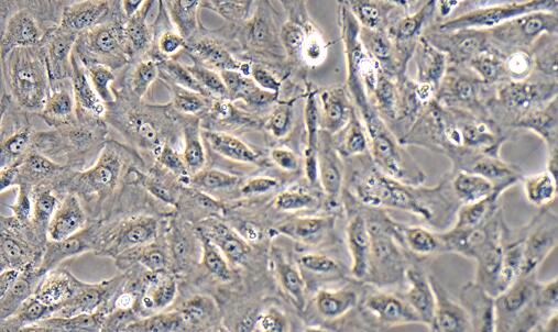 Human HK-2 Tubular Epithelial Cells (HK-2)