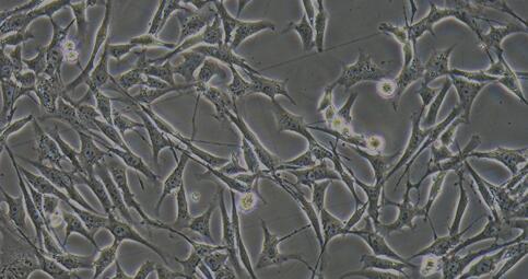 Mouse HT22 Hippocampal Neuron Cells (HT22)