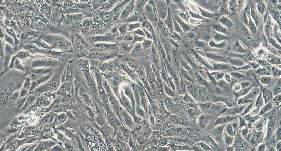 Mouse bEnd.3 Brain Microvascular Endothelial Cells (bEnd.3)