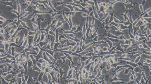 Mouse 3T3-L1 Embryonic Fibroblasts (3T3-L1)