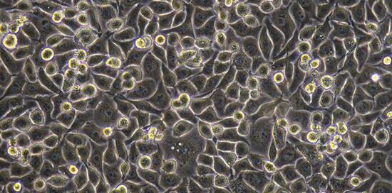 Human CNE-2Z Nasopharyngeal Carcinoma Cells (CNE-2Z)