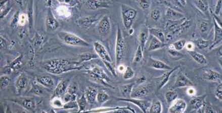 Human NP69 Nasopharyngeal Epithelial Cells (NP69)