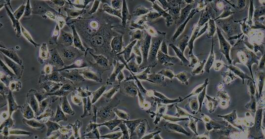 Human MDA-MB-231 Triple-negative Breast Cancer Cells (MDA-MB-231)