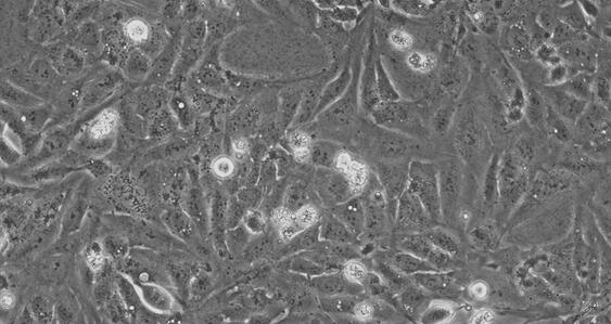 Human U-2OS Osteosarcoma Cells (U-2OS)