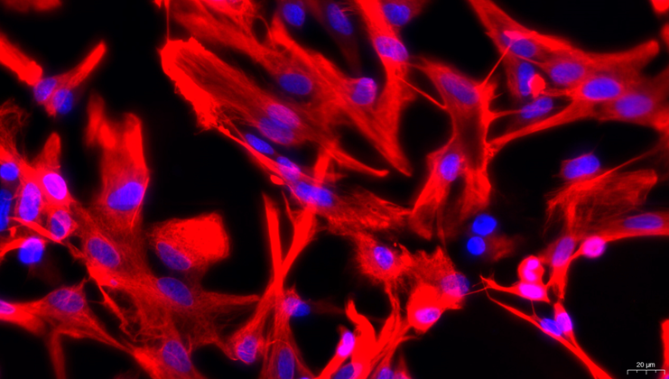 Primary Perineurial Fibroblasts Perineurial Fibroblasts (PNF)