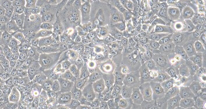 Human Kyse150 Esophageal Squamous Cell Carcinoma Cells (Kyse150)