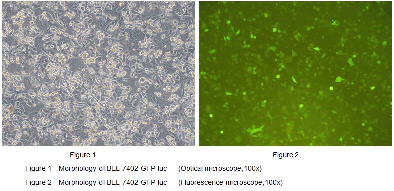 Human Luciferase BEL-7402 Hepatocellular Carcinoma Cells (BEL-7402-Luc	)