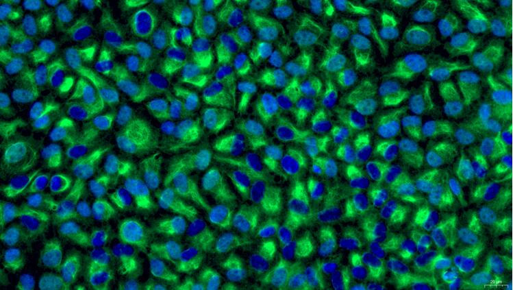 Primary Caprine Testicular Microvascular Endothelial Cells (TMEC)