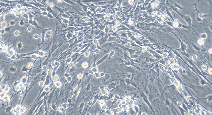 Primary Rat Spinal Cord Perineurial Fibroblasts (SCPF)