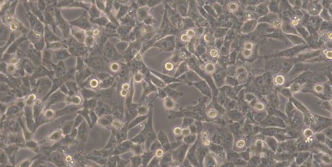 Human WPMY-1 Normal Prostate Stromal Immortalized Cells (WPMY-1)