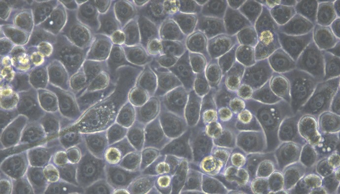 Human PC-9 Lung Adenocarcinoma Cells (PC-9)