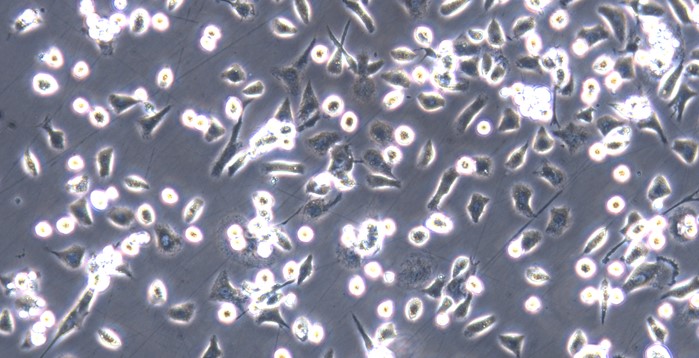 Primary Mouse Bone Marrow-Derived Macrophage Cells (BMDM)