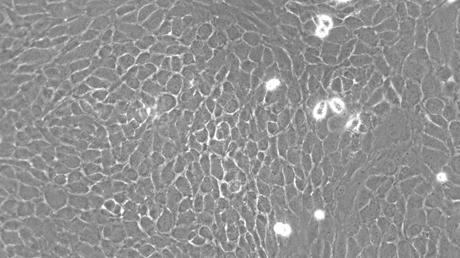 Primary Rat Olfactory Epithelial Cells (OEC)