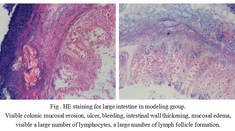 Mouse Model for Colitis