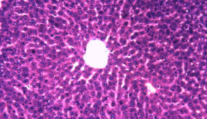 Mouse Model for Intrahepatic Cholestasis (IC)