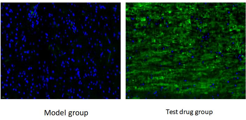 Mouse Model for Actue Spinal Cord Injury (ASCI)