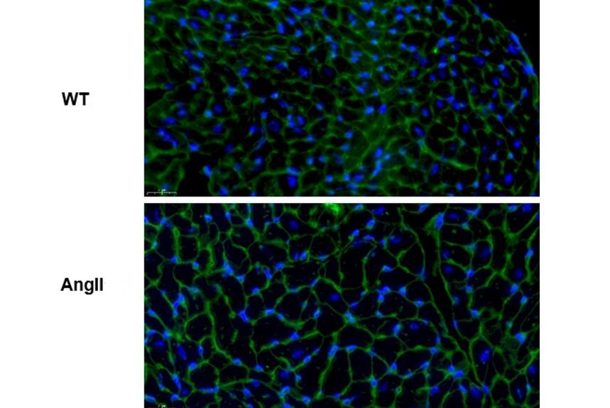 Mouse Model for Cardiac Hypertrophy (CH)