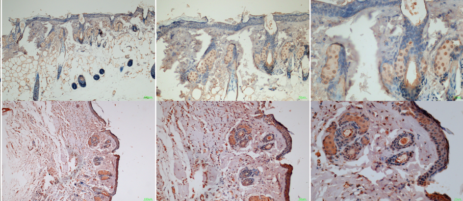 Mouse Model for Thermal Injury (TI)