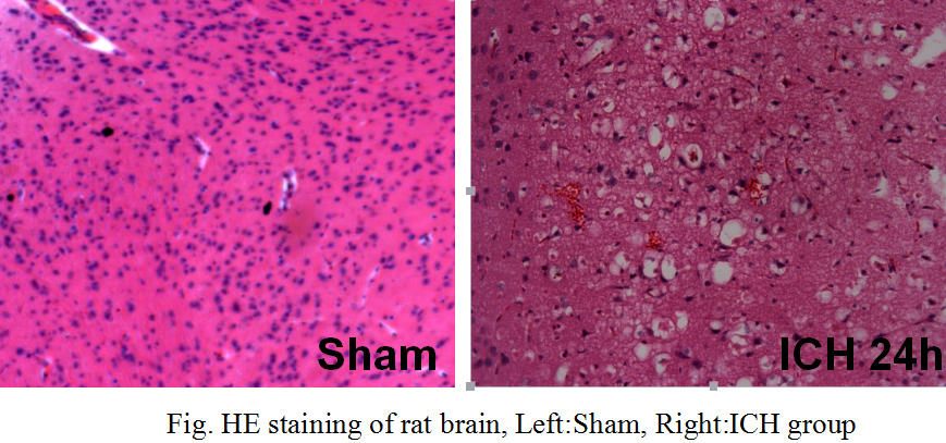 Rat Model for Intracerebral Hematoma (IH)