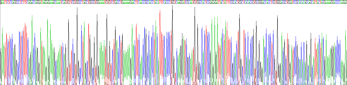 Eukaryotic Glycogen Phosphorylase, Muscle (PYGM)