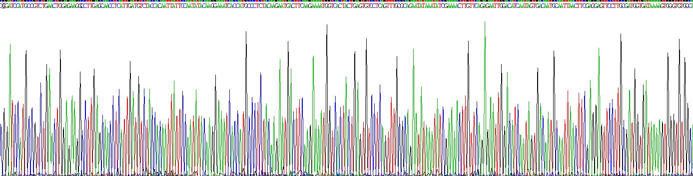 Eukaryotic S100 Calcium Binding Protein A8 (S100A8)