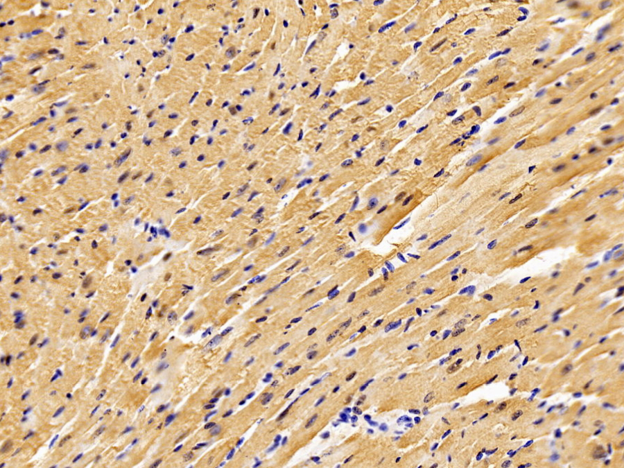 Biotin-Linked Polyclonal Antibody to S100 Calcium Binding Protein (S100)