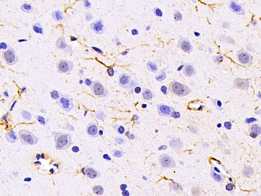 Biotin-Linked Polyclonal Antibody to Glial Fibrillary Acidic Protein (GFAP)