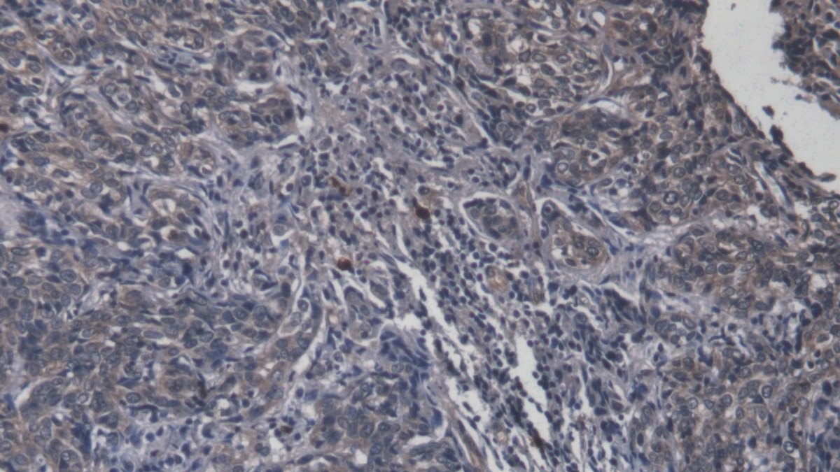 FITC-Linked Monoclonal Antibody to Interleukin 8 (IL8)