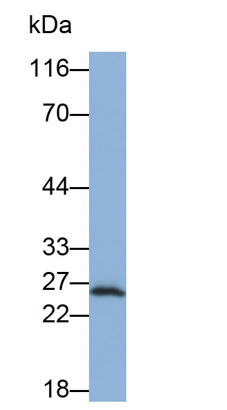 Biotin-Linked Polyclonal Antibody to Tissue Inhibitors Of Metalloproteinase 4 (TIMP4)