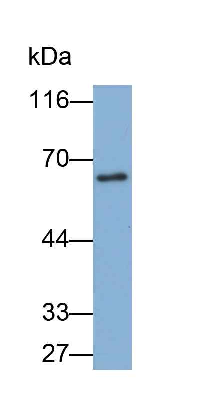 Biotin-Linked Polyclonal Antibody to Alpha-Fetoprotein (AFP)