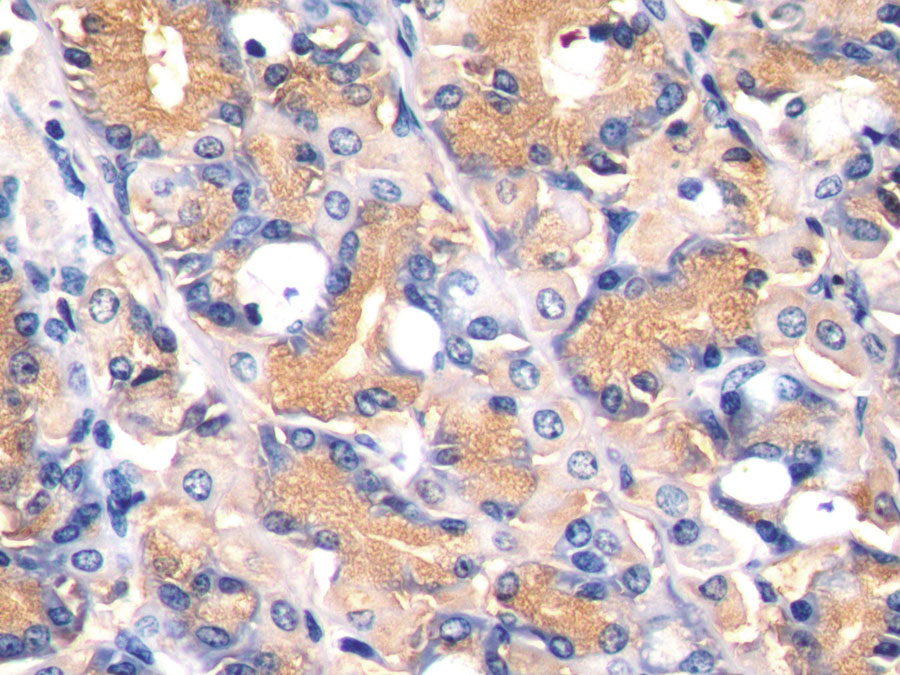 Biotin-Linked Polyclonal Antibody to Alpha-Fetoprotein (AFP)