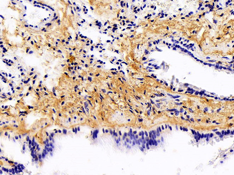 Biotin-Linked Polyclonal Antibody to Collagen Type I Alpha 2 (COL1a2)