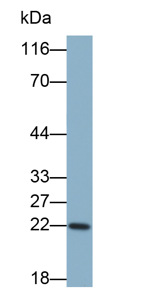 Biotin-Linked Polyclonal Antibody to Interleukin 1 Receptor Antagonist (IL1RA)