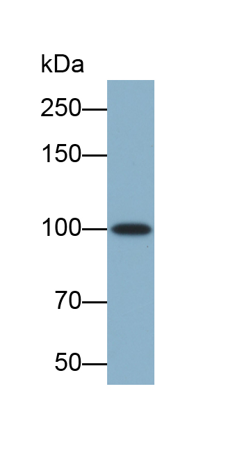 Biotin-Linked Monoclonal Antibody to Complement 1 Inhibitor (C1INH)